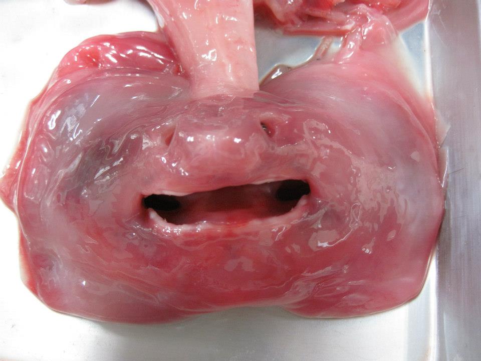 Cc Embryo